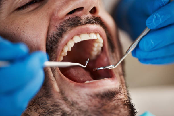 Best TMJ/TMD Treatment  in Cibolo, TX
