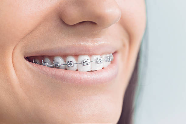 TMJ/TMD Treatment in Cibolo, TX